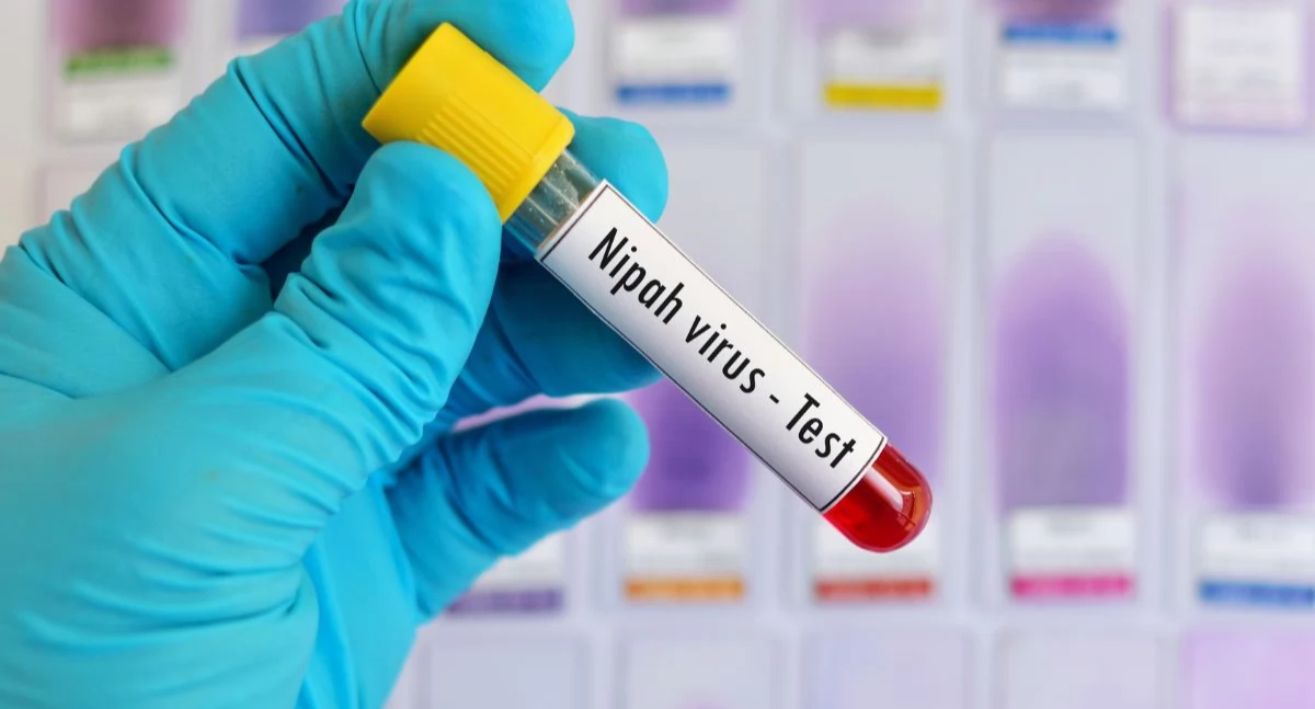Prof. Piotr Rzymski: wirus Nipah nie stanowi obecnie dla nas zagrożenia epidemicznego