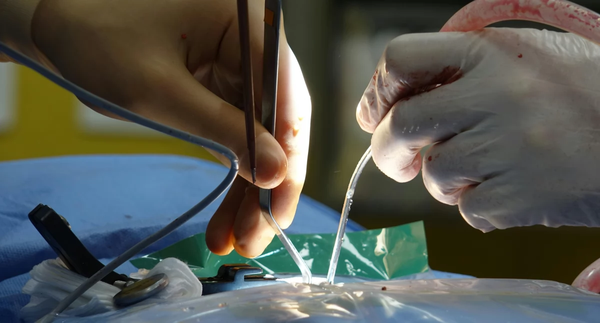 Bielski szpital wdraża system Volt. Migotanie przedsionków będzie leczone bezpieczniej