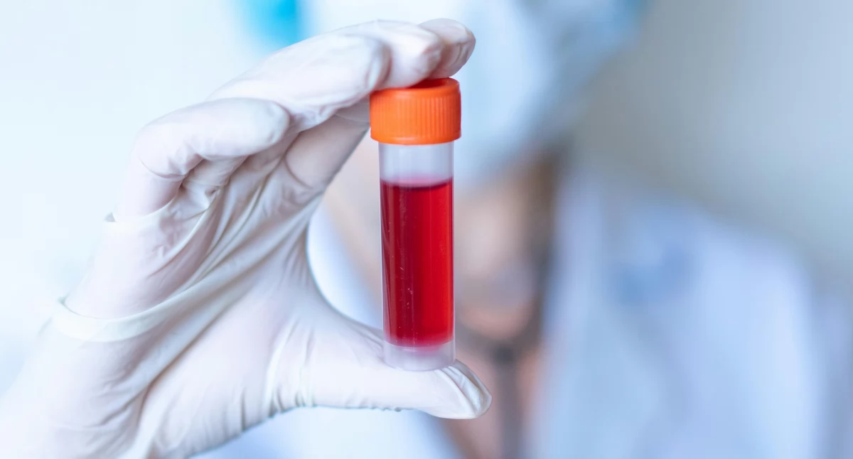 Nowy standard opieki hematologicznej w Polsce coraz bliżej