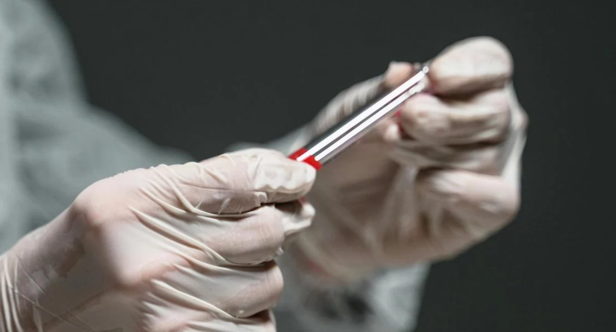 Anemia aplastyczna - gdy szpik przestaje pracować