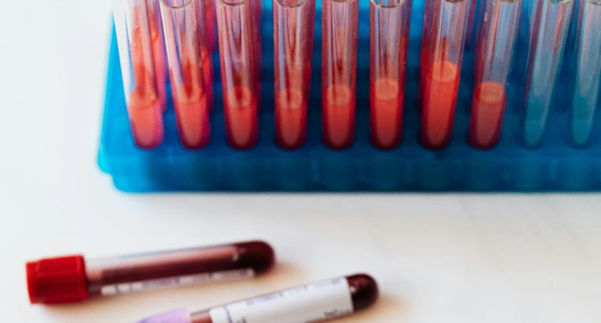 Diagnostyka onkologiczna w Polsce traci tempo. MZ: spadła terminowość badań w 2026 roku