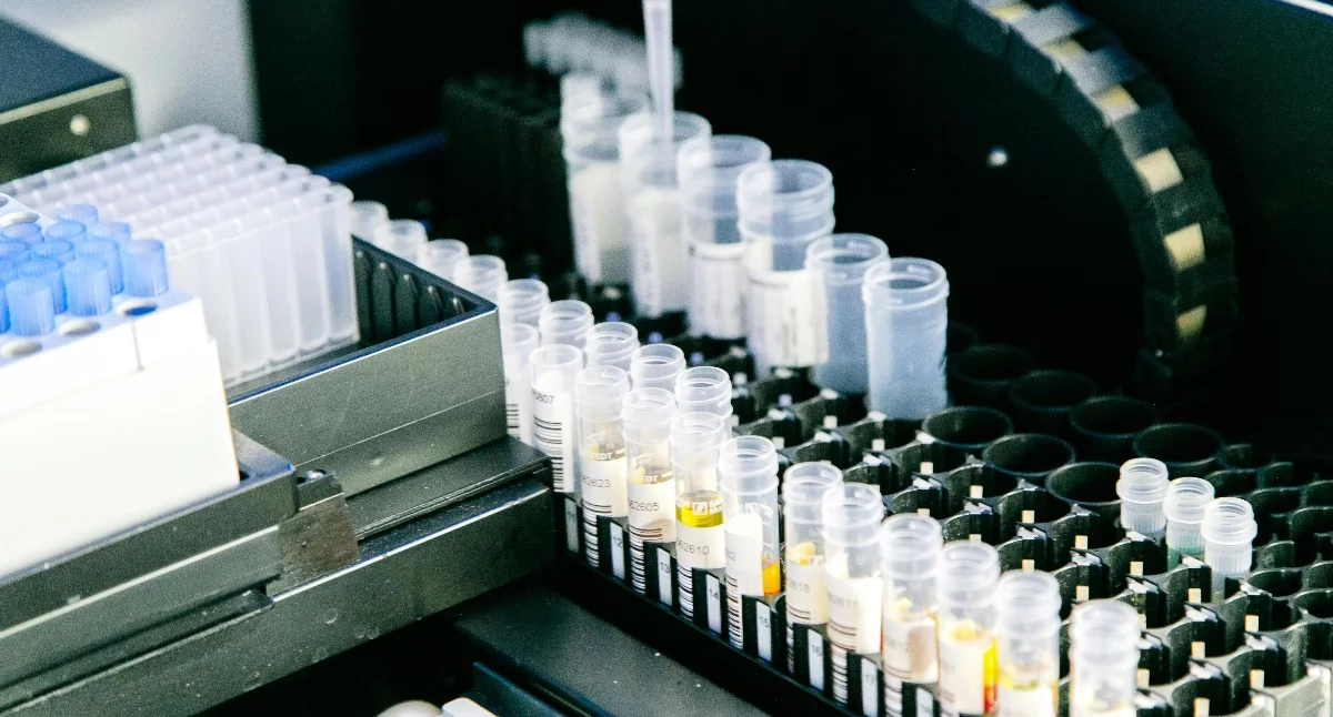 USK Rzeszów inwestuje ponad 1,5 mln zł w nowoczesną diagnostykę raka