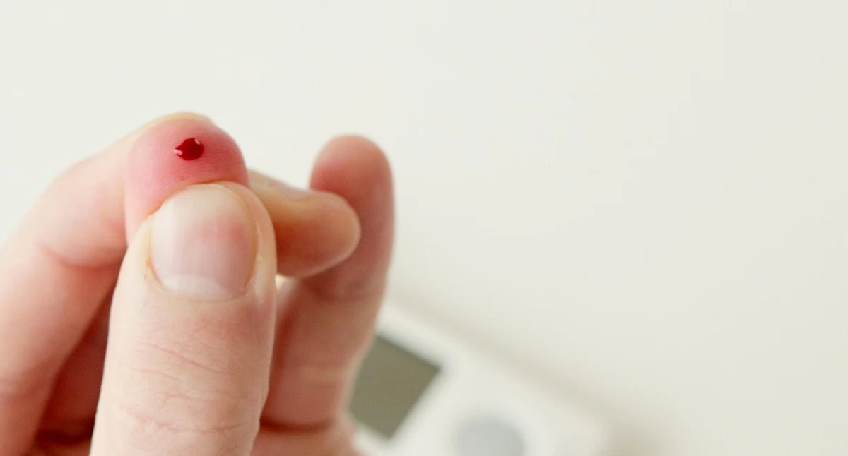 Nowe normy cholesterolu LDL 2026: 100 mg/dl to już za dużo. Miliony pacjentów w nowej grupie ryzyka