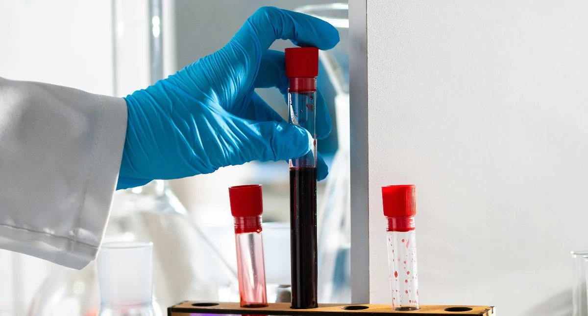Diagnostyka onkologiczna bez limitów dla pacjentów z kartą DiLO. NFZ zapewnia pełne finansowanie