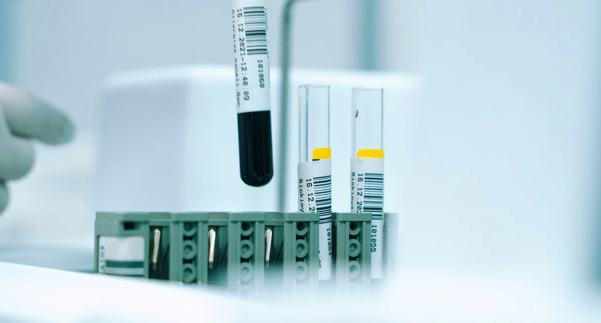 ABM ogłasza nowy konkurs na badania kliniczne. Do podziału jest 300 mln zł