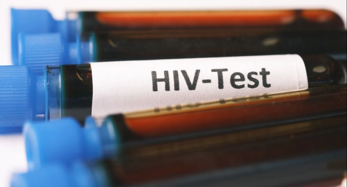 Zmiany w Krajowym Programie Zapobiegania HIV i Zwalczania AIDS: Projekt trafił do prac rządu
