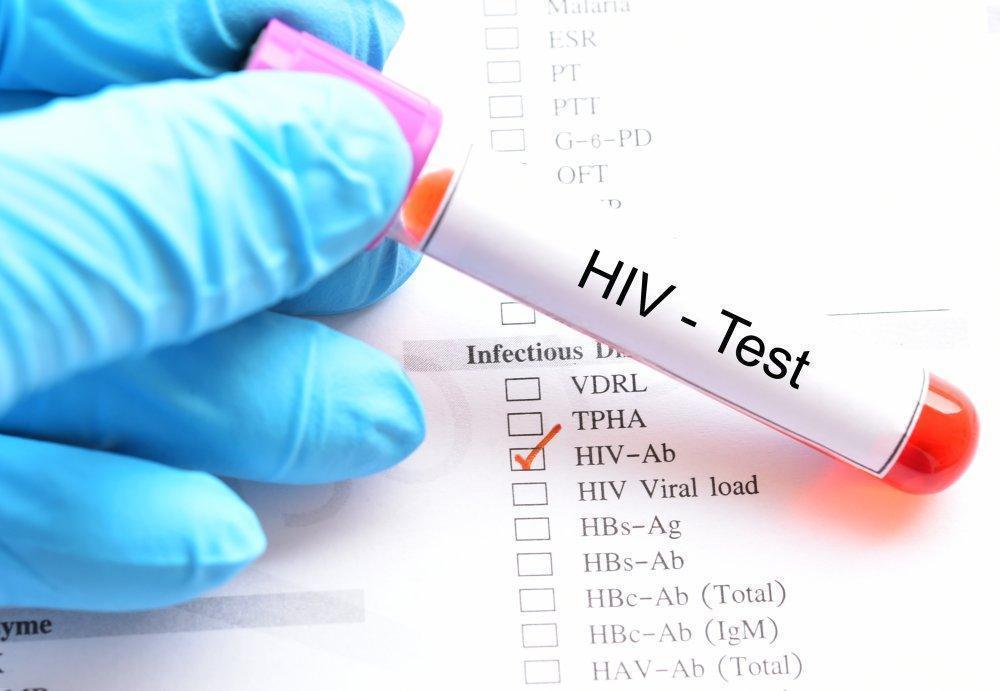 Wirus HIV może sam się cofnąć?