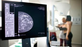 Nowe zalecenia w stosowaniu badań mammograficznych