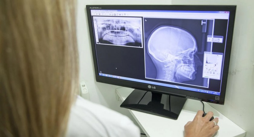 Pierwsza udana operacja z użyciem tytanowej żuchwy, wydrukowanej w 3D