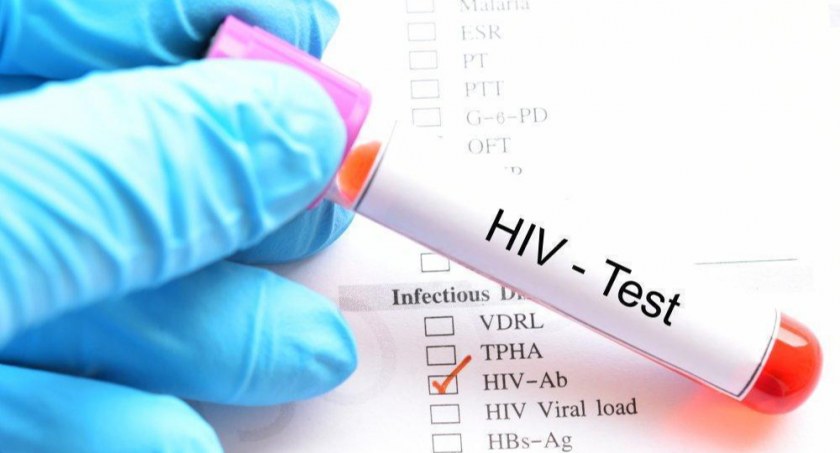 HIV to nie wyrok