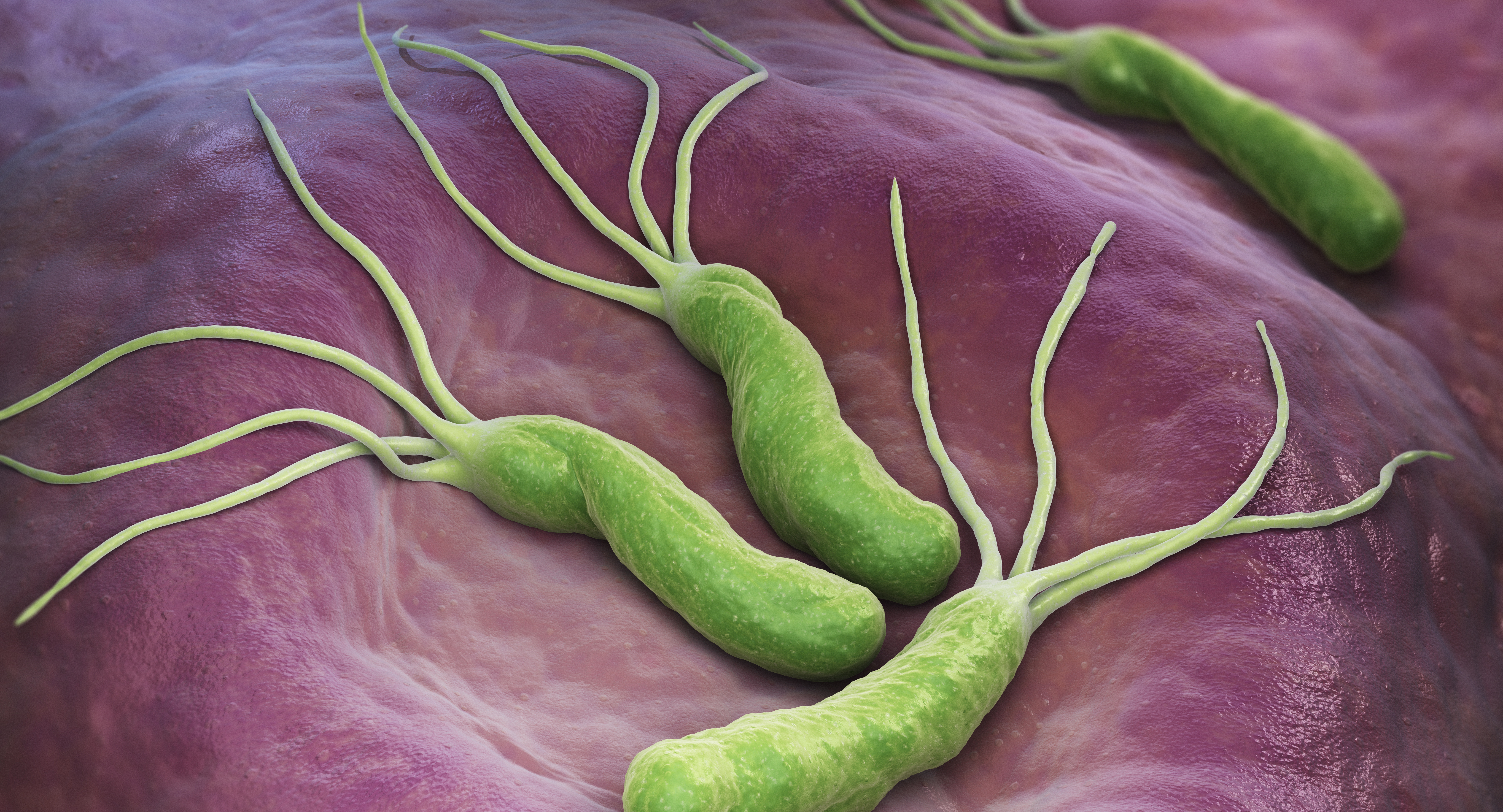 Helicobacter pylori - choroba cywilizacyjna?