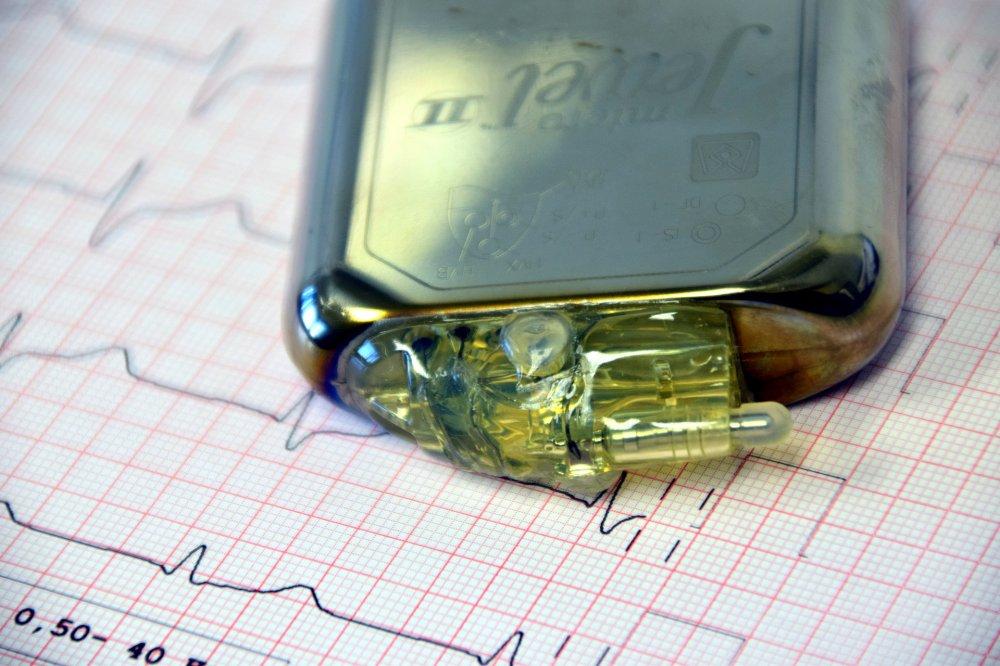 E-papieros zakłócił pracę defibrylatora serca