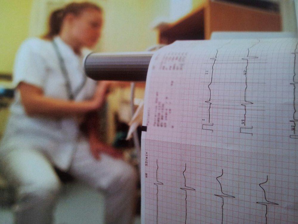 Aptekarz skieruje na EKG? Dlaczego nie!