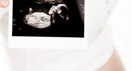 Relacja z 20. Światowego Kongresu Medycyny Płodowej