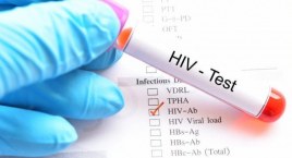 GSK: decyzja EMA o dopuszczeniu do obrotu leku zapobiegającego zakażeniom HIV 