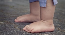 Płaskostopie najczęstszą wadą stóp u dzieci