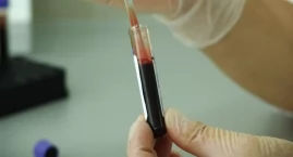 Jeśli osoba z HIV się leczy, nie zarazi swojego partnera