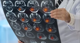 Eisai: obiecujące wyniki leku na chorobę Alzheimera podawanego podskórnie