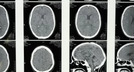 Diamentowy pył jako kontrast w rezonansie magnetycznym