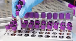 Nowe badania ujawniają unikalne wzorce aktywności mózgu u pacjentów z anoreksją