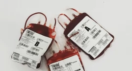 Anemia – objawy i leczenie niedokrwistości