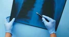 Polacy umierają na raka, bo nie robią badań. Ekspert: Trzeba do nich dotrzeć inaczej