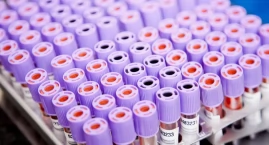 Gotowa immunoterapia CAR-NKT może zmienić leczenie r&hellip;