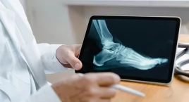 Nowy cel w leczeniu osteoporozy: receptor GPR133. Pr&hellip;
