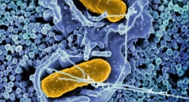 Badanie mikrobiomu jelitowego: nowy standard diagnostyczny? Ekspert UJ wyjaśnia, co już dziś jest możliwe