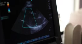 Krajowa Sieć Kardiologiczna wprowadza nowe obowiązki dla szpitali