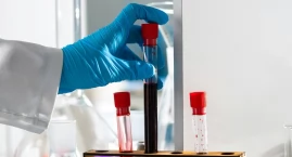 Diagnostyka onkologiczna bez limitów dla pacjentów z kartą DiLO. NFZ zapewnia pełne finansowanie