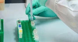 Biotech Act pod ostrzałem. Krajowi Producenci Leków: dłuższy monopol ograniczy dostęp do terapii biologicznych