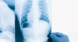 POChP to już trzecia przyczyna zgonów w Polsce. Miliony chorych nie wiedzą o swojej chorobie