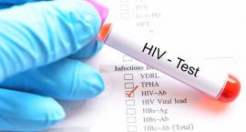 Światowy dzień AIDS. Wciąż niezbędna edukacja