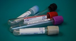 Projekt ustawy o medycynie laboratoryjnej skierowany do prac w komisji