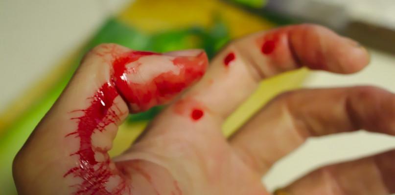 Potworna tragedia na prywatnej posesji. 40-latka nadziała się na żeliwny płot!