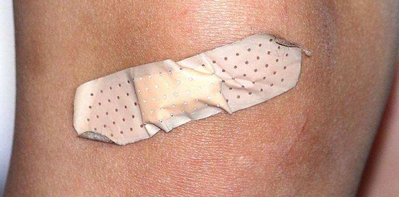 Kiedy sam plasterek nie wystarczy. Nie lekceważ urazów kolana, żeby niepotrzebnie nie pogłębić uszkodzeń