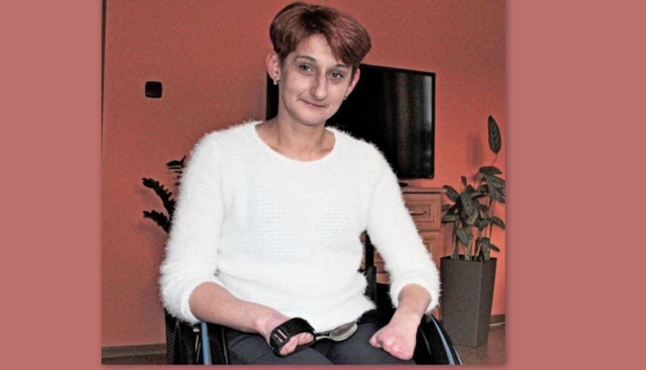Agnieszka przeszła 28 amputacji, mimo to stara się być samodzielna