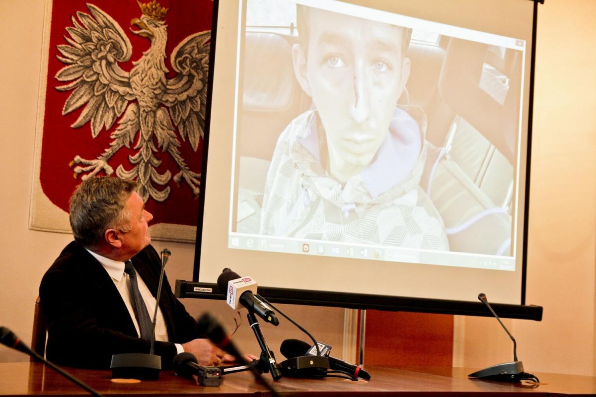 Czy doszło do pobicia? Prokuratura stawia zarzuty wójtowi
