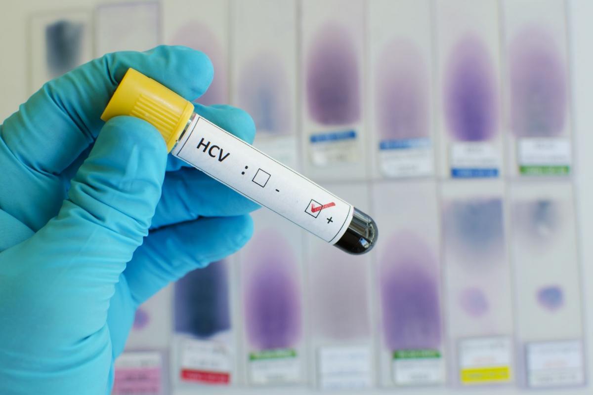 Bezpłatne badania na HCV w Przemyślu