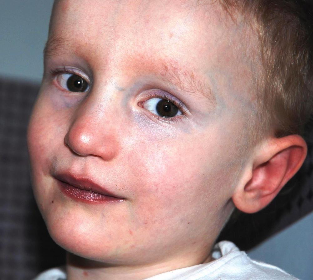 Zebrali dla Emilka ponad 3 tys. zł. Potrzeba znacznie więcej