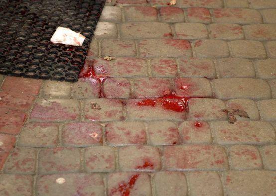 24-latek raniony nożem. Policja zatrzymała 1 osobę