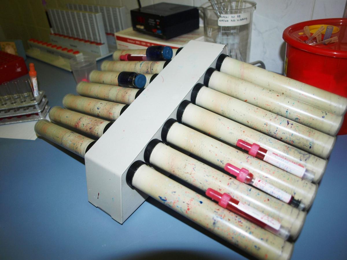 Zbliżają się wakacje. Szpitale potrzebują krwi