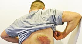 – Pobili mnie policjanci – mówi pan Mariusz