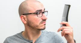 Skuteczne sposoby na wypadanie włosów u mężczyzn