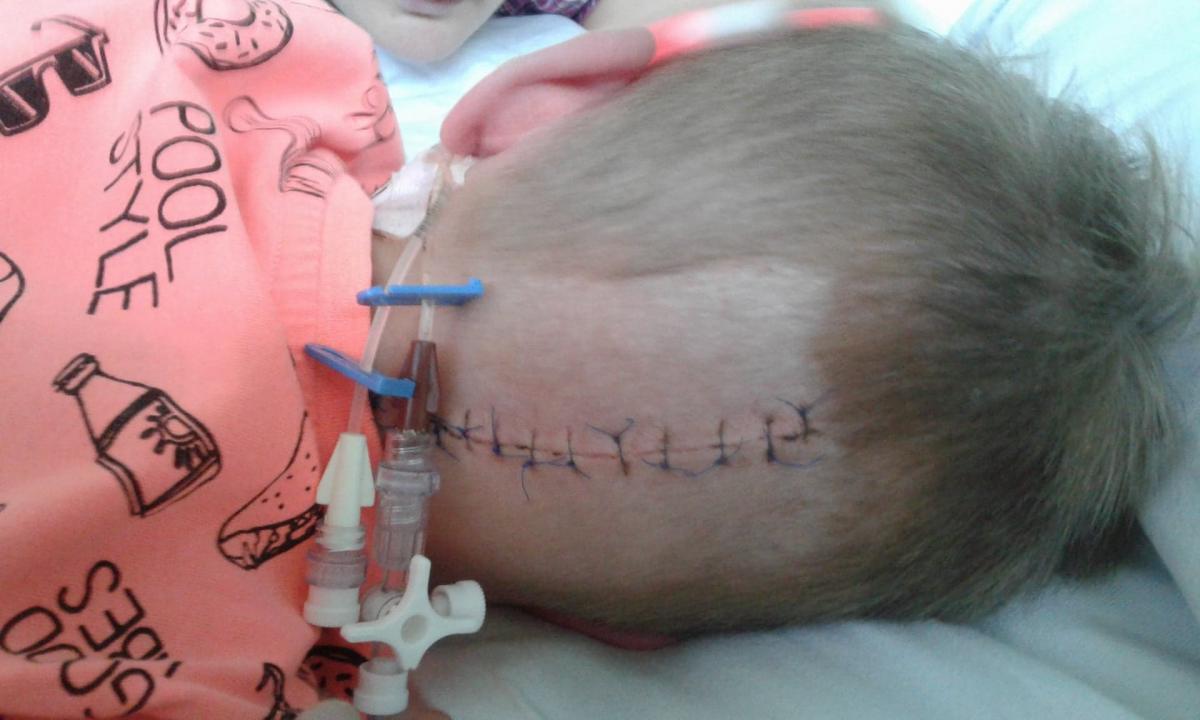 Trwa walka o życie czteroletniego  Patryka