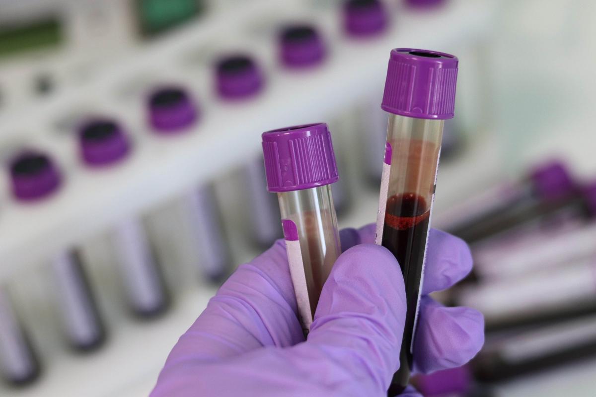 MZ: kolejne 26 przypadków koronawirusa; łącznie 927, bilans ofiar wzrósł do 12