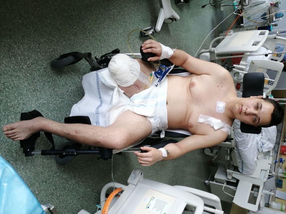 - Proszę, pomóż mi znów chodzić - mówi Wojtek, który zbiera pieniądze na protezę