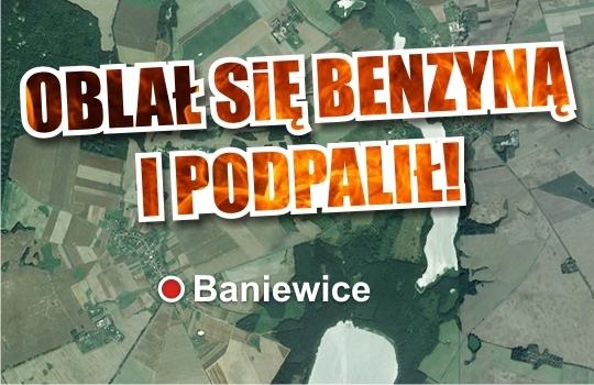 Oblał się benzyną i podpalił