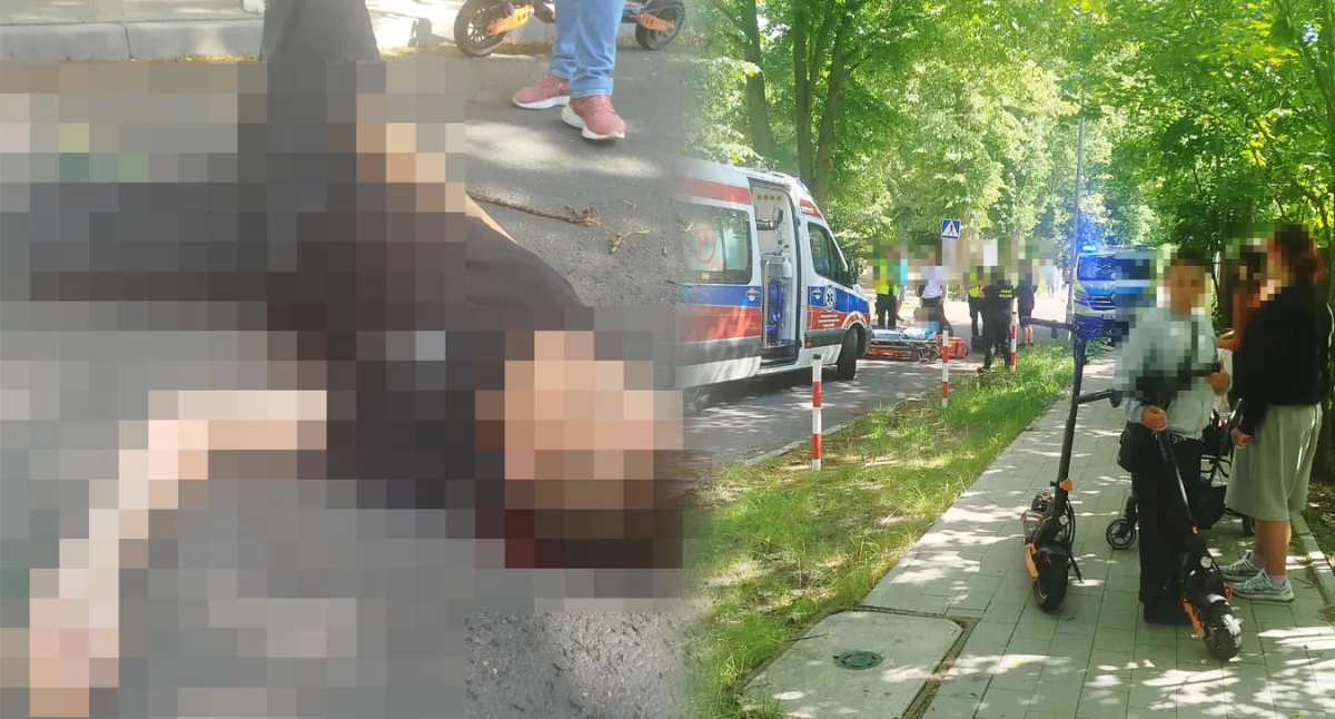 Groźny upadek z hulajnogi. Uderzył głową w asfalt, pojawiło się dużo krwi